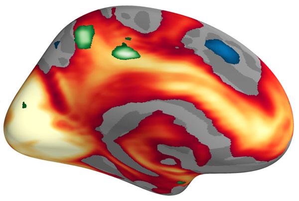 Brain, emotions.jpg
